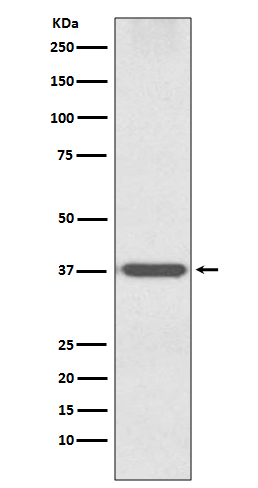 OTX1 Rabbit mAb ABZ5012