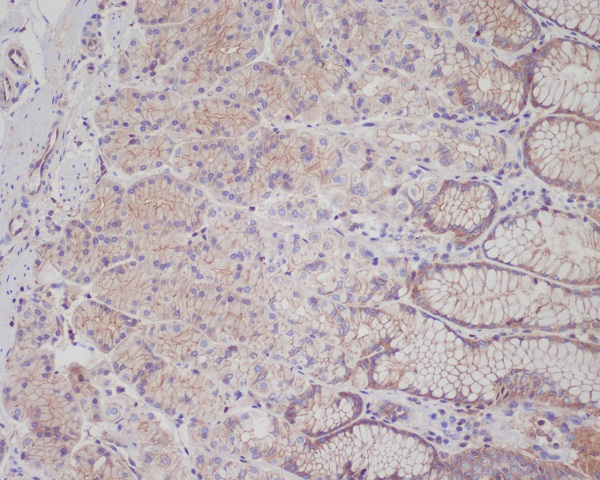 c-Met Rabbit mAb ABZ5013