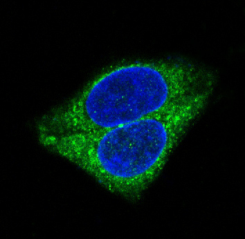 Synaptophysin Rabbit mAb ABZ5014