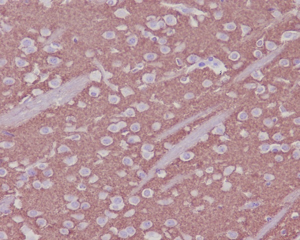 Synaptophysin Rabbit mAb ABZ5014