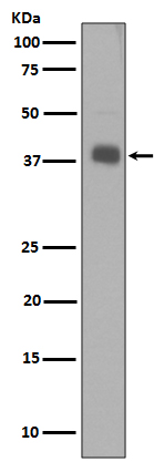 Synaptophysin Rabbit mAb ABZ5014
