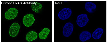 Histone H2A.X Rabbit mAb ABZ5015