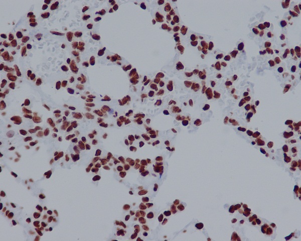 Histone H2A.X Rabbit mAb ABZ5015