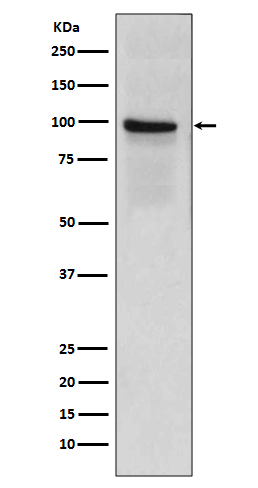 Thrombomodulin Rabbit mAb ABZ5016