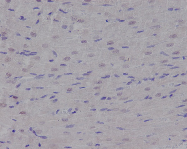 Nibrin Rabbit mAb ABZ5018