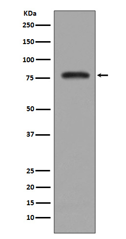 PKC beta 2 Rabbit mAb ABZ5021
