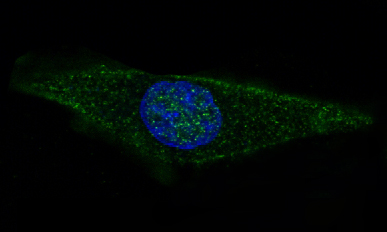 GFAP Rabbit mAb ABZ5022