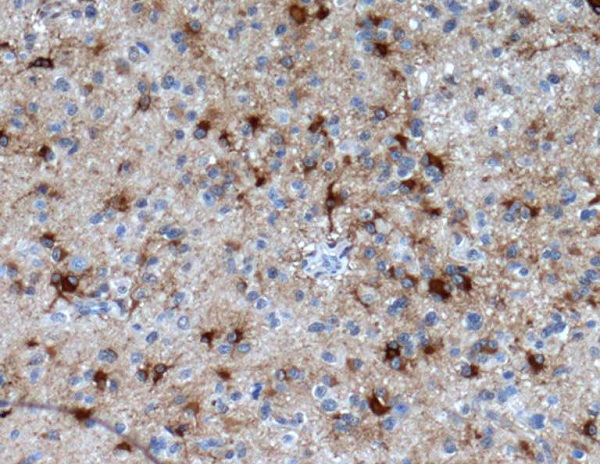 GFAP Rabbit mAb ABZ5022