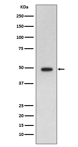 GFAP Rabbit mAb ABZ5022