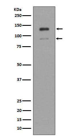 Interferon alpha/beta Receptor 1 Rabbit mAb ABZ5024