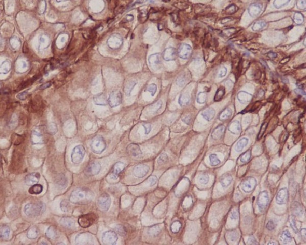 Integrin beta 1 Rabbit mAb ABZ5025