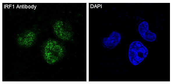 IRF1 Rabbit mAb ABZ5028
