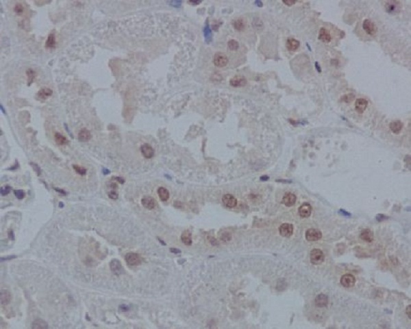 IRF1 Rabbit mAb ABZ5028