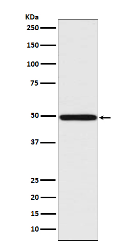 IRF1 Rabbit mAb ABZ5028