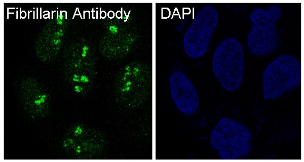 Fibrillarin Rabbit mAb ABZ5029