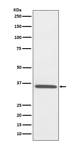 Fibrillarin Rabbit mAb ABZ5029