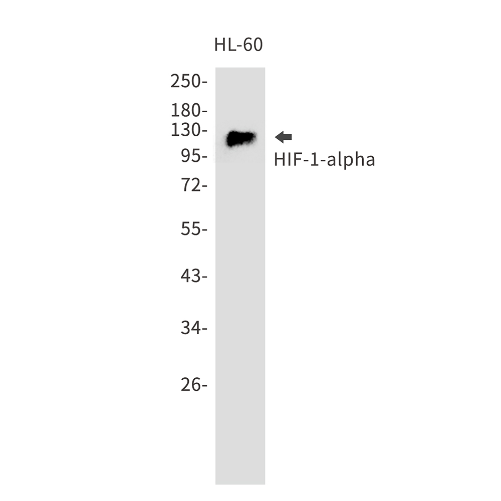 HIF1 alpha Rabbit mAb ABZ5031