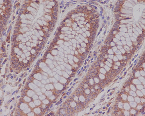 Rab5 Rabbit mAb ABZ5032