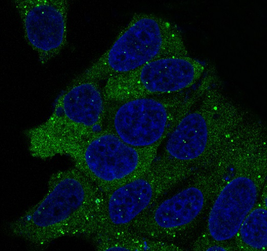 Hsp90 alpha/beta Rabbit mAb ABZ5034