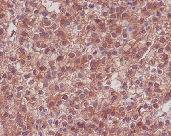 Hsp90 alpha/beta Rabbit mAb ABZ5034