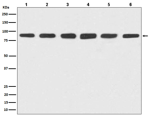 Hsp90 alpha/beta Rabbit mAb ABZ5034