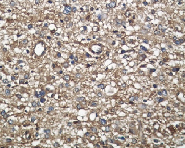 Midkine Rabbit mAb ABZ5036