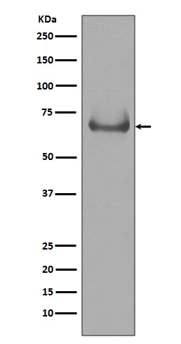Lamin B Receptor Rabbit mAb ABZ5037