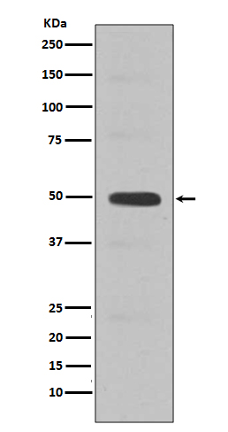 Cyclin E2 Rabbit mAb ABZ5039