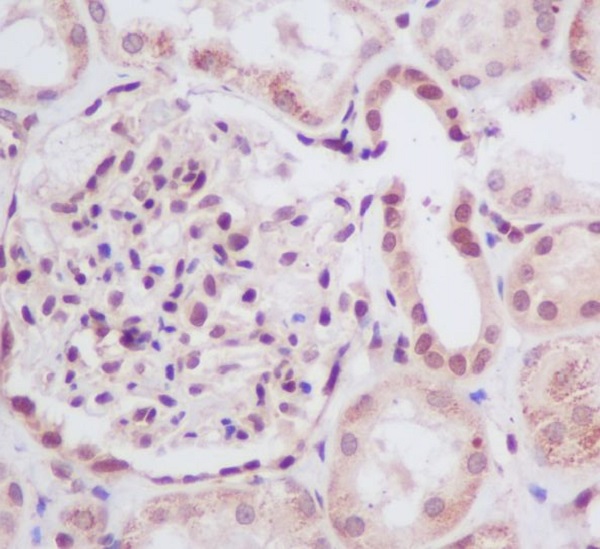 SUMO Conjugating Enzyme UBC9 Rabbit mAb ABZ5040