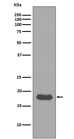 SUMO Conjugating Enzyme UBC9 Rabbit mAb ABZ5040