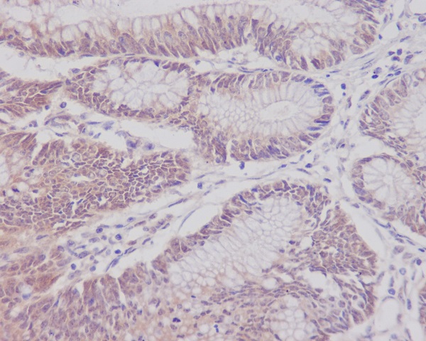 CD3 epsilon Rabbit mAb ABZ5041