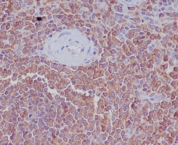Radixin Rabbit mAb ABZ5044