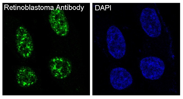 Rb Rabbit mAb ABZ5045