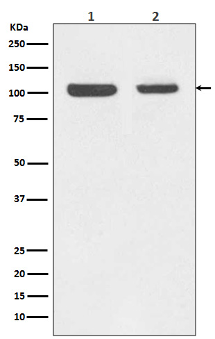 Rb Rabbit mAb ABZ5045