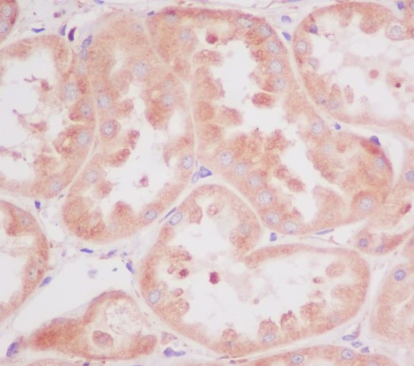 RPS20 Rabbit mAb ABZ5046