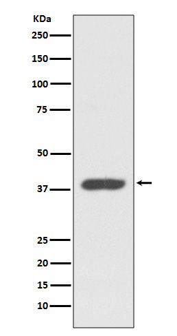 GPCR RDC1/CXCR-7 Rabbit mAb ABZ5047