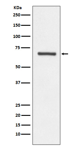 ANGPT1 Rabbit mAb ABZ5048