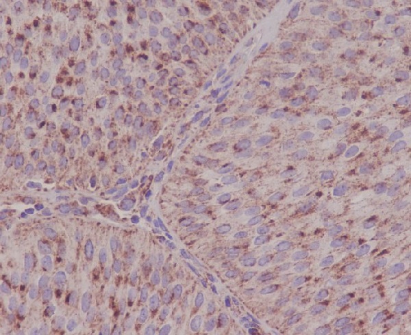 Asparagine Synthetase Rabbit mAb ABZ5049