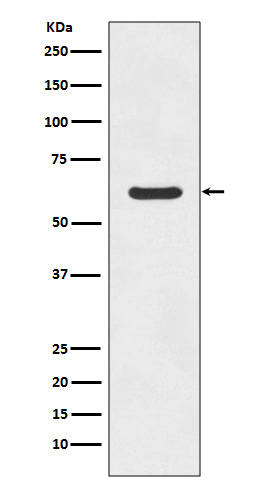 Asparagine Synthetase Rabbit mAb ABZ5049