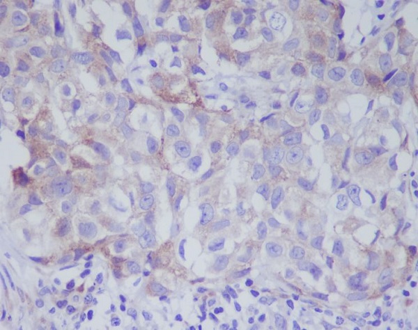 VAV2 Rabbit mAb ABZ5051