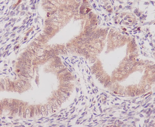 Cyclooxygenase 1 Rabbit mAb ABZ5052