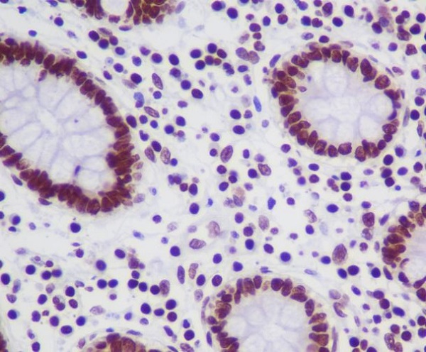 Topoisomerase I Rabbit mAb ABZ5053