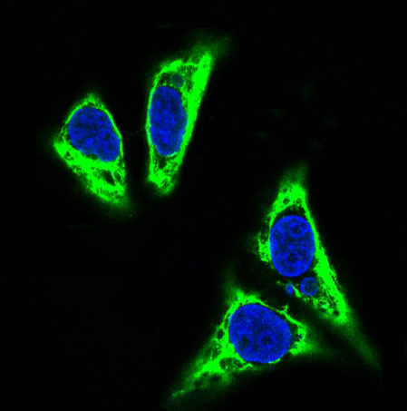 TNFAIP3 Rabbit mAb ABZ5054