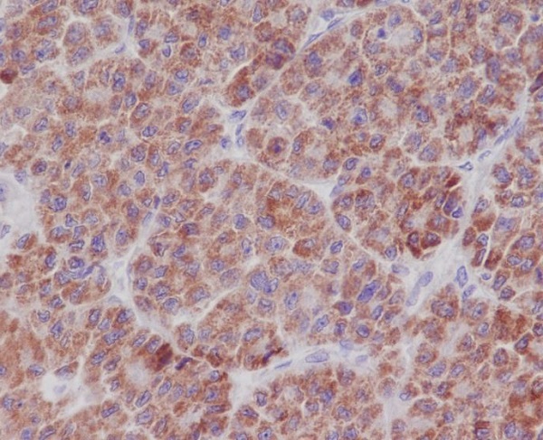 TNFAIP3 Rabbit mAb ABZ5054