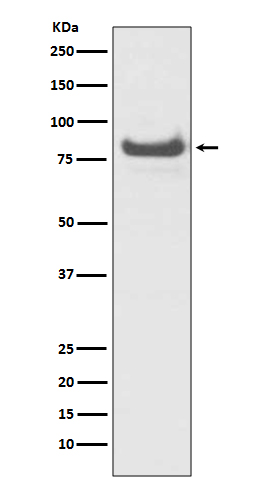 TNFAIP3 Rabbit mAb ABZ5054