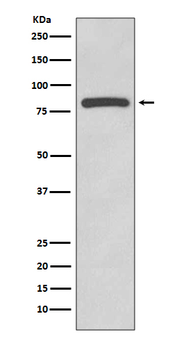 Glycogen synthase 1/GYS1 Rabbit mAb ABZ5056
