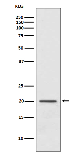 ARF1 Rabbit mAb ABZ5058