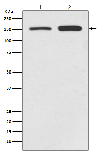 SMC1A Rabbit mAb ABZ5059