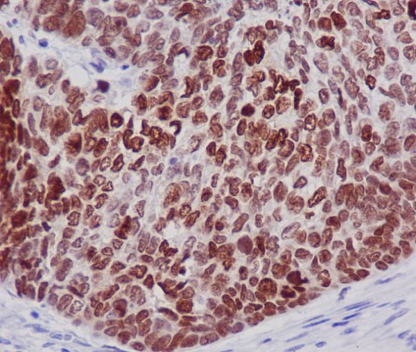 Histone H2B Rabbit mAb ABZ5060
