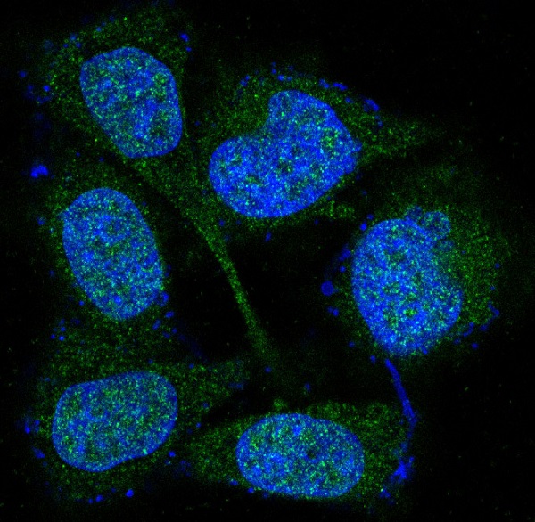 MEK3/MEK6 Rabbit mAb ABZ5061
